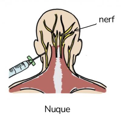 Bloc nerveux